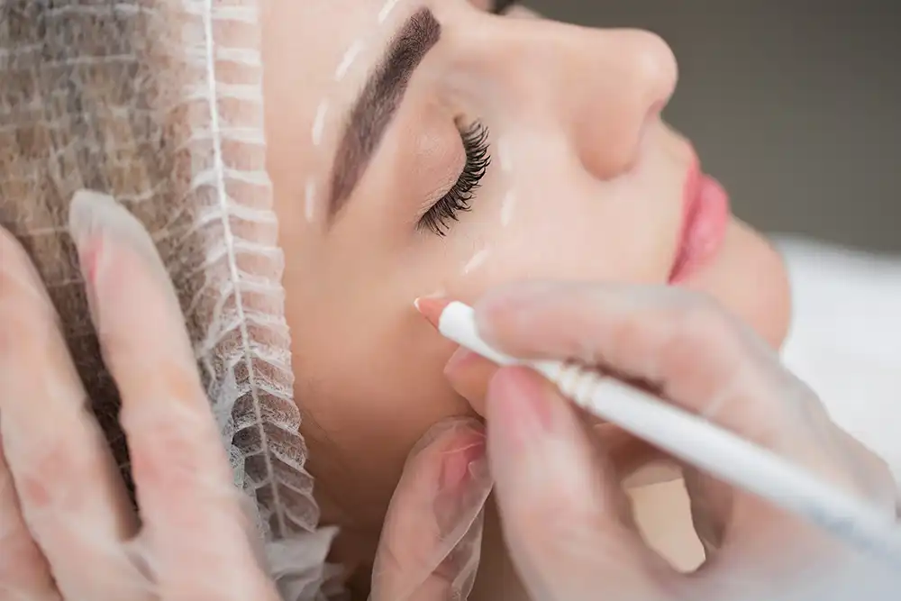 plastic surgeon marking a face